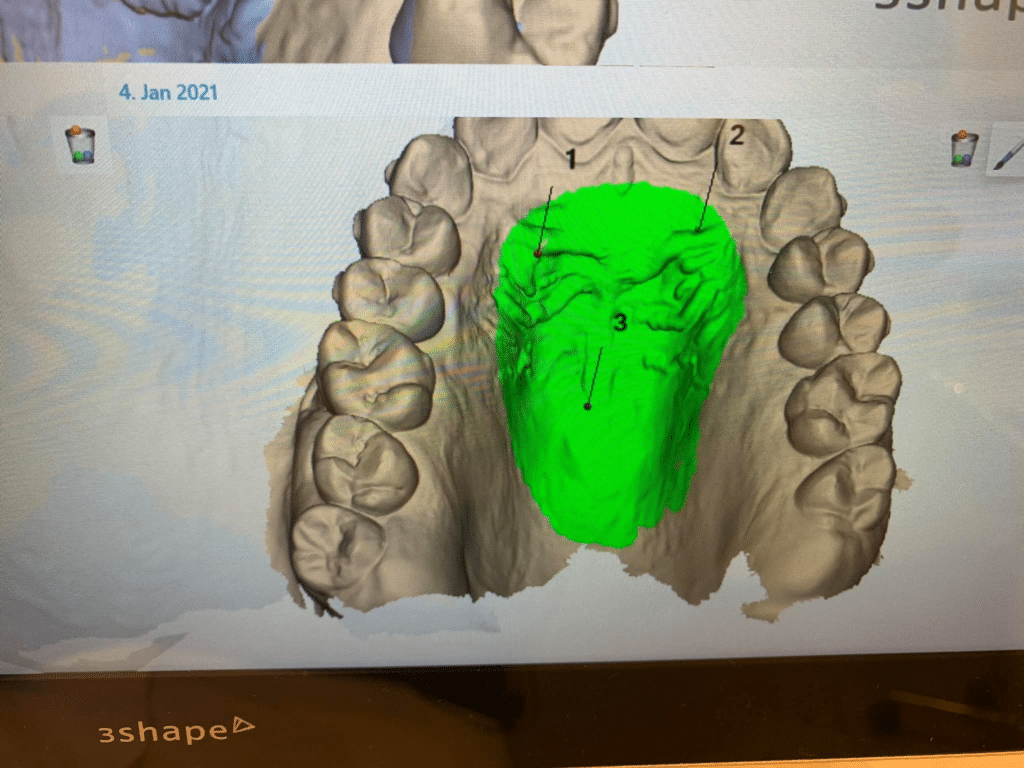 3Shape TRIOS 4 Wireless Pod INTRAORAL SCANNER | Universadent Inc