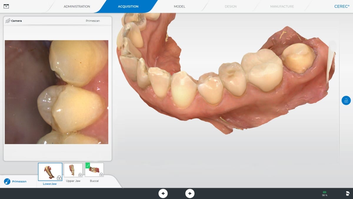 У внутриротового сканера primescan cerec dentsply sirona отсутствует функция