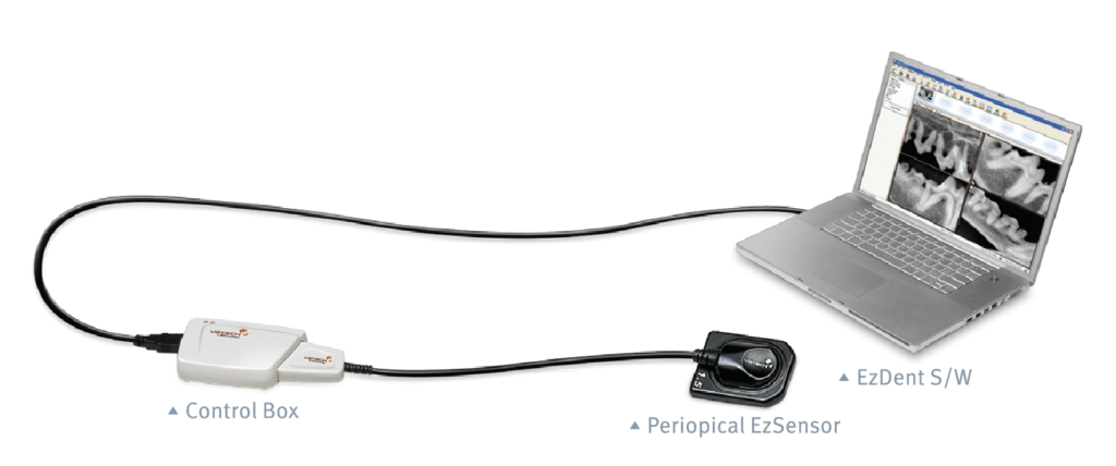 EZSensor-Digital-Intraoral-Sensor