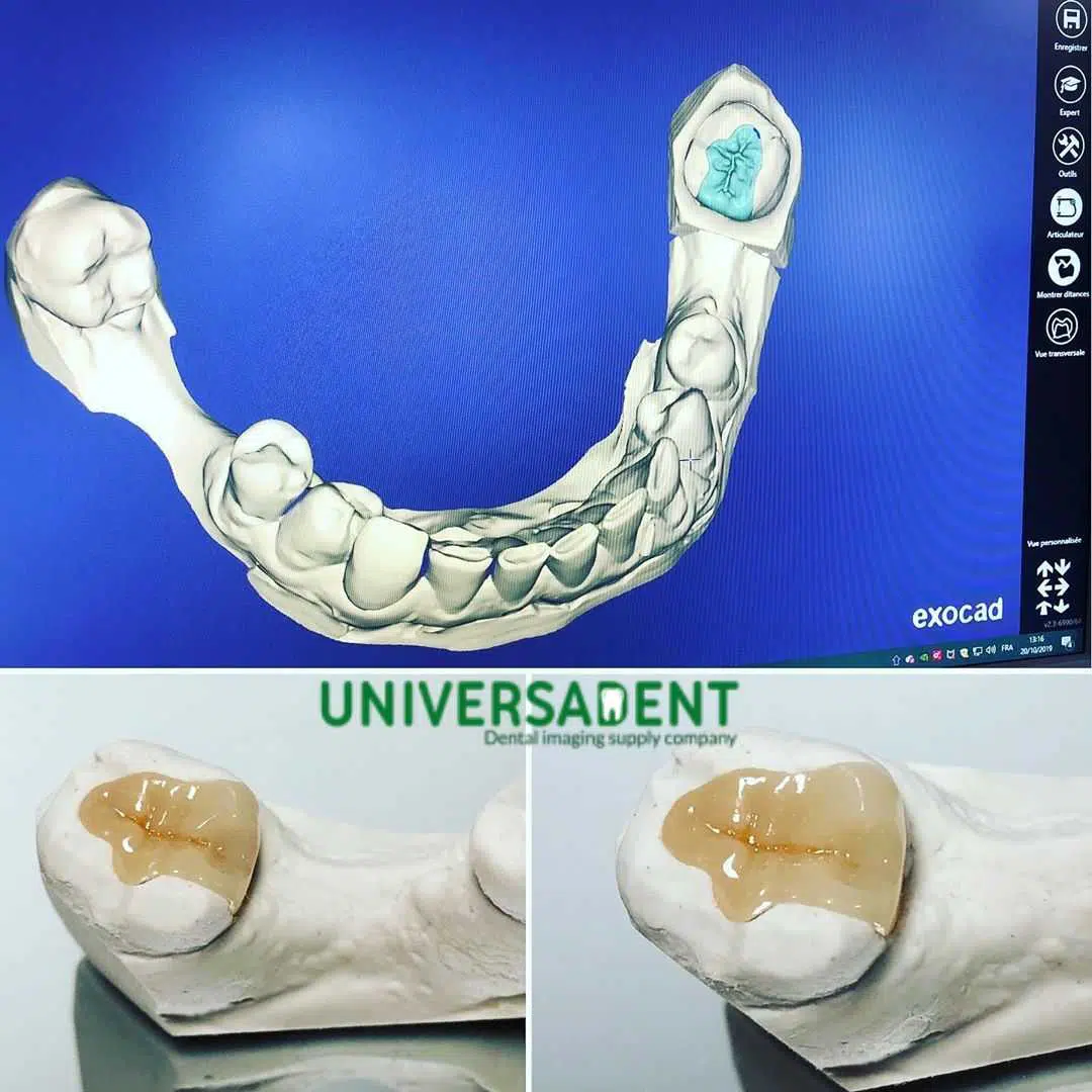 Medit T500 Dental 3D Scanner