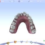 planscan software