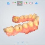aoralscan for sale