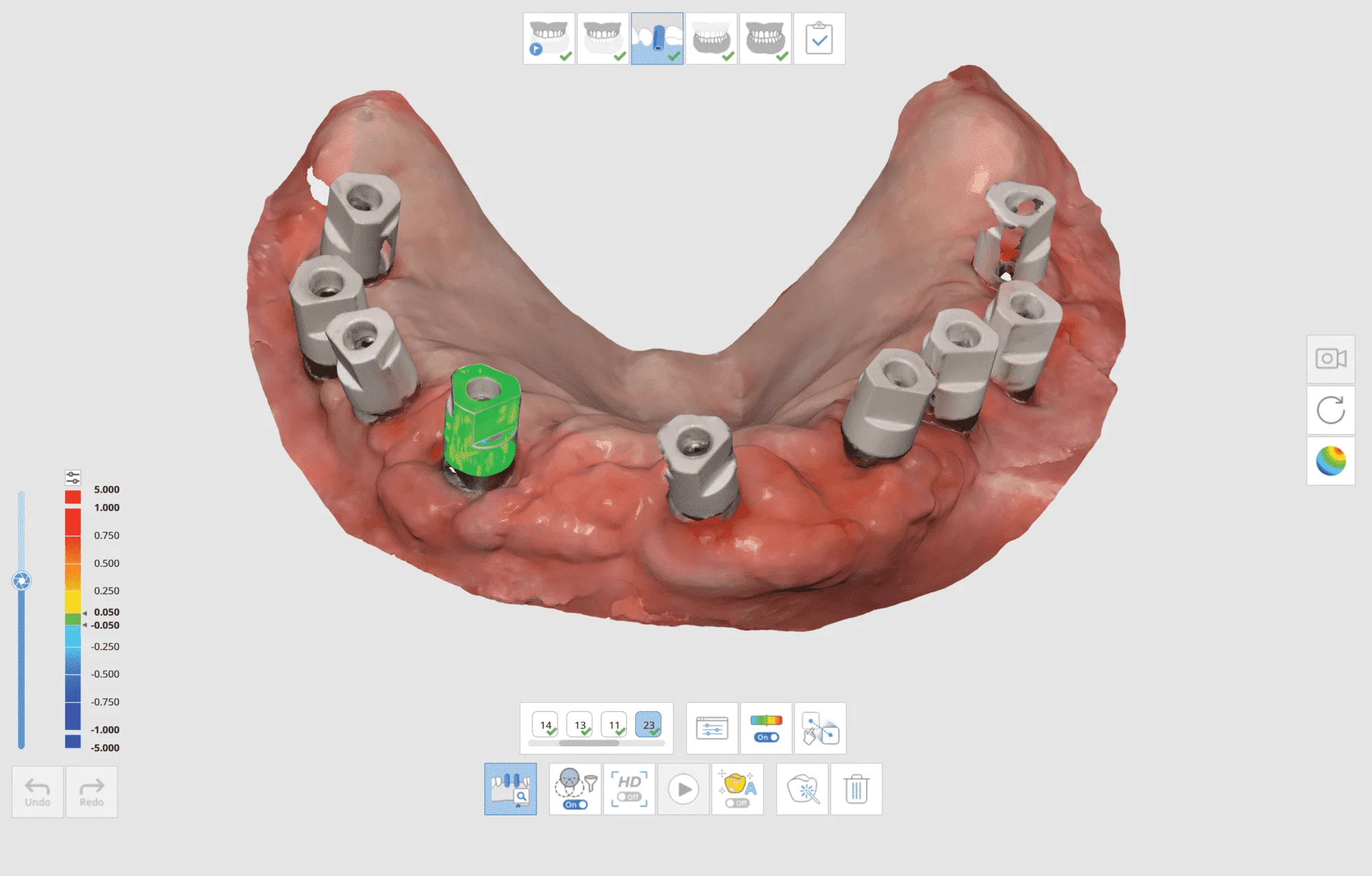 Medit i700 Wireless Intraoral 3D Scanner for Dental Clinics