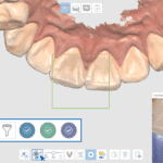 Medit i700 Wireless Intraoral 3D Scanner for Dental Clinics