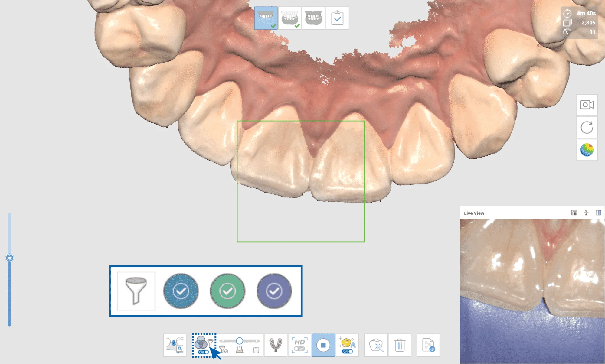 Medit i700 Wireless Intraoral 3D Scanner for Dental Clinics