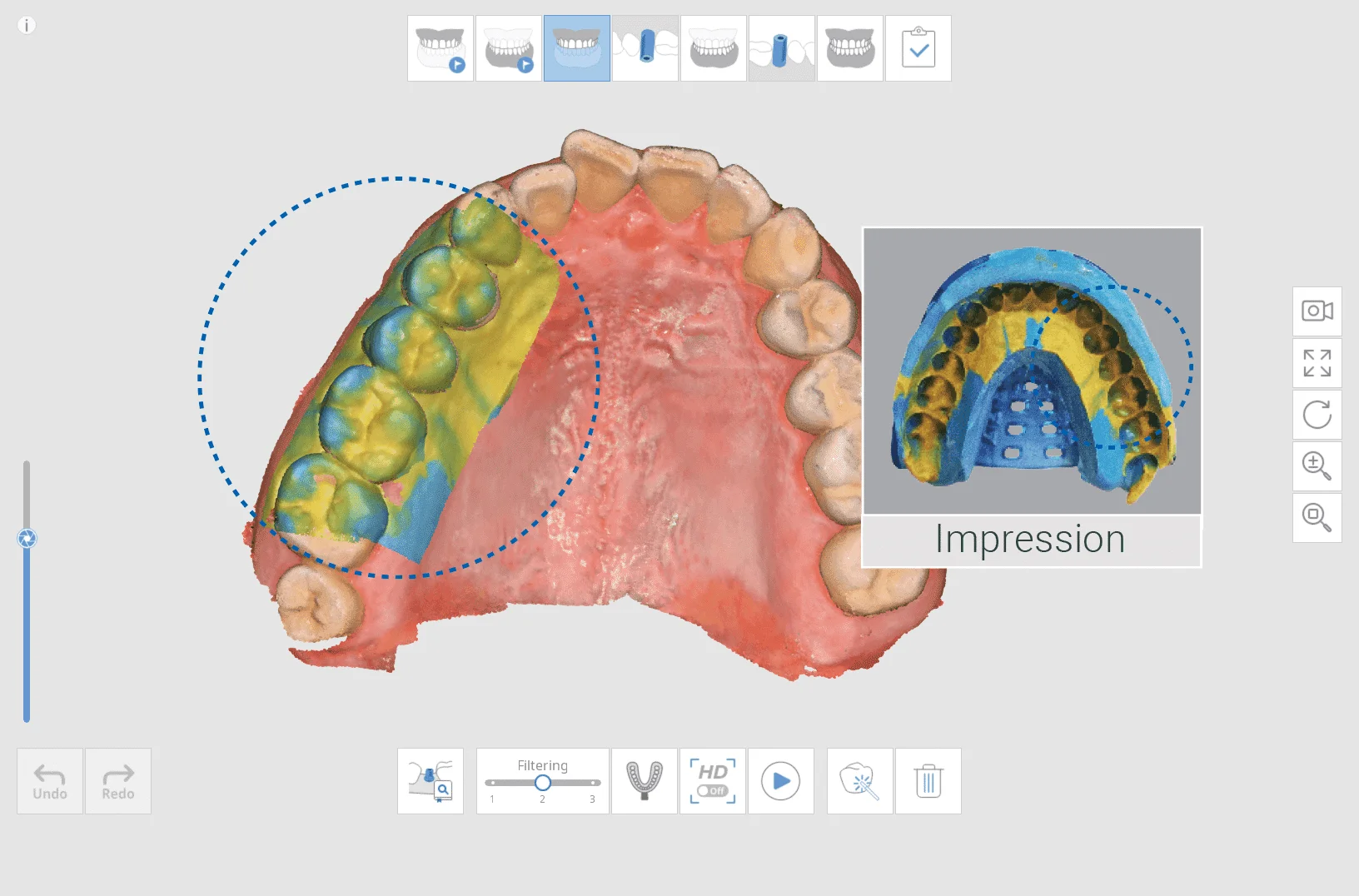 Medit i700 Wireless Intraoral 3D Scanner for Dental Clinics