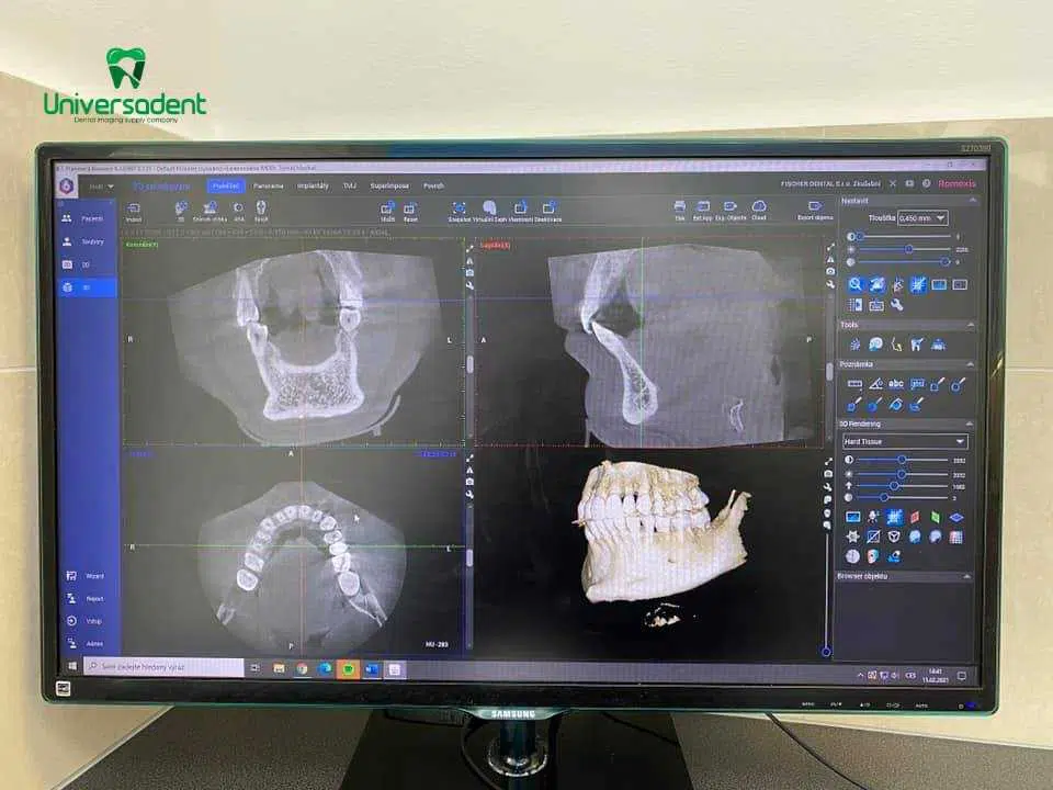 Planmeca ProMax 3D Classic