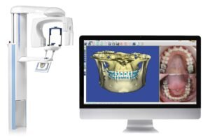 Planmeca ProMax 3D Classic