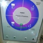 Waterlase Express Biolase Tissue Laser