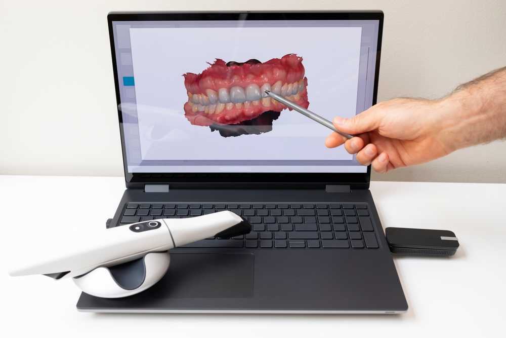 Choosing the Right Intraoral Scanner