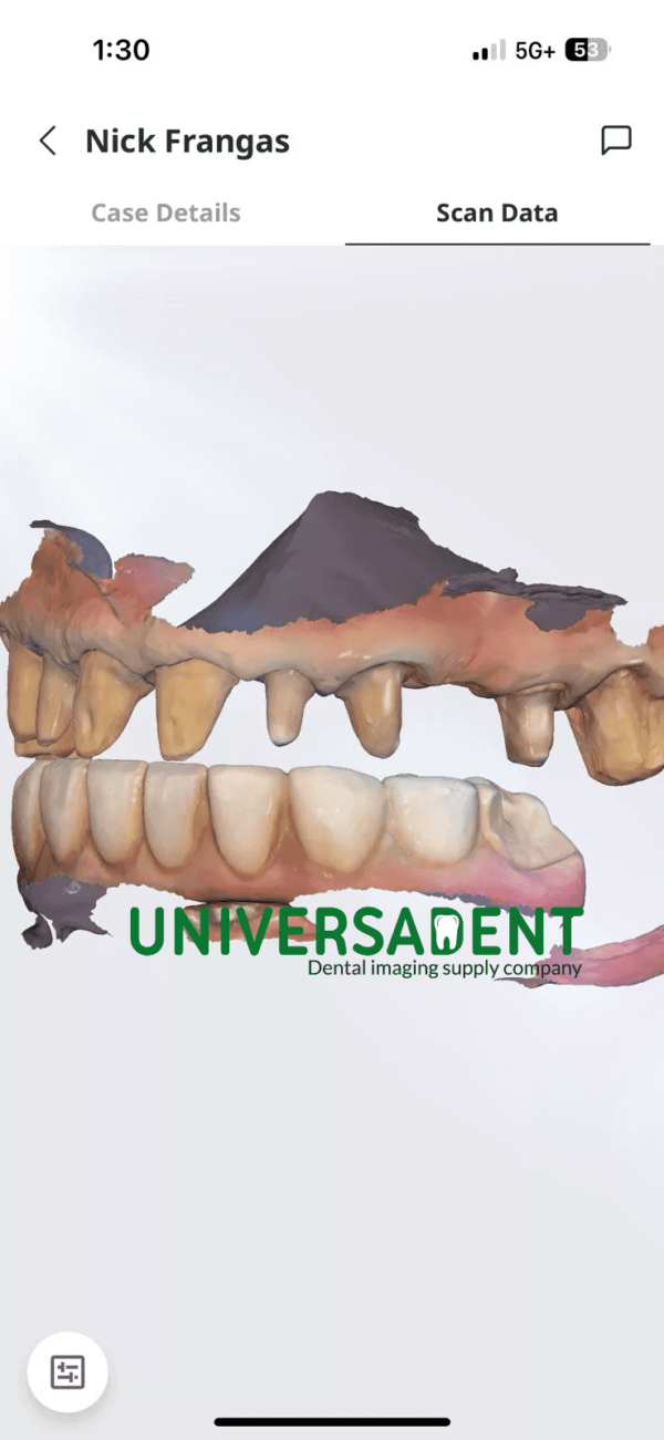 Medit i900 3D Intraoral Scanner