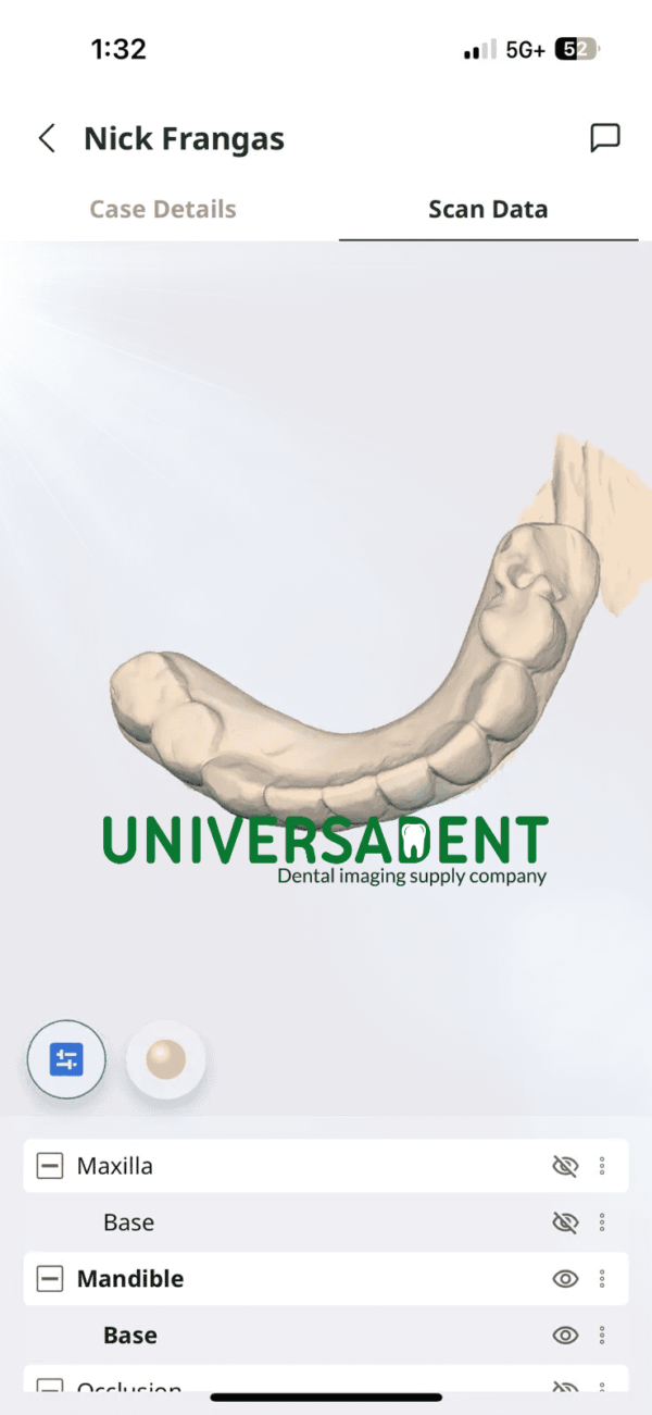 Medit i900 3D Intraoral Scanner