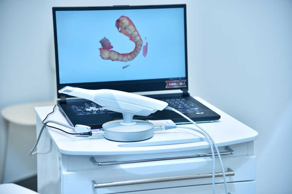 Intraoral Scanner Work