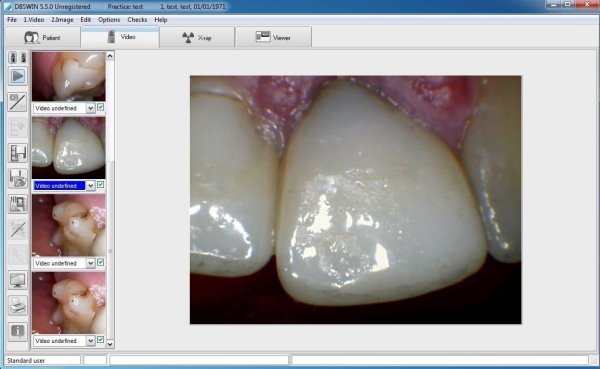 DBSWIN-Imaging-Software