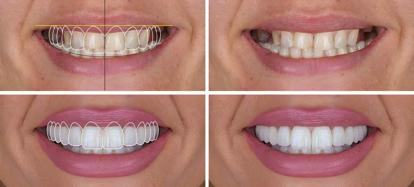 Cosmetic Dentistry