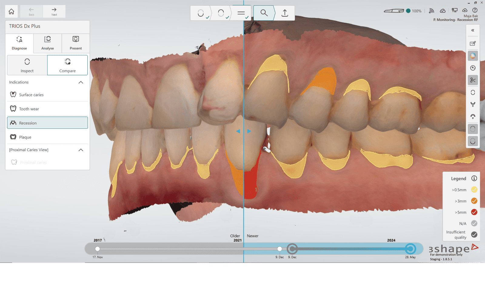 Dx-Plus_Screenshot_Recession-Comparison