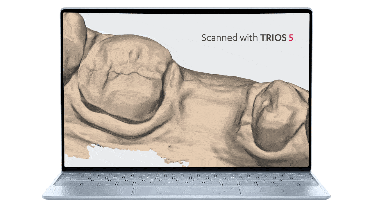 Redefining scan quality