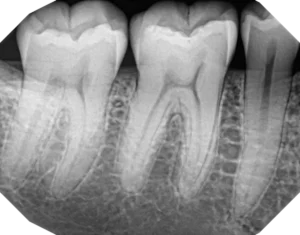 High-clarity images on demand 