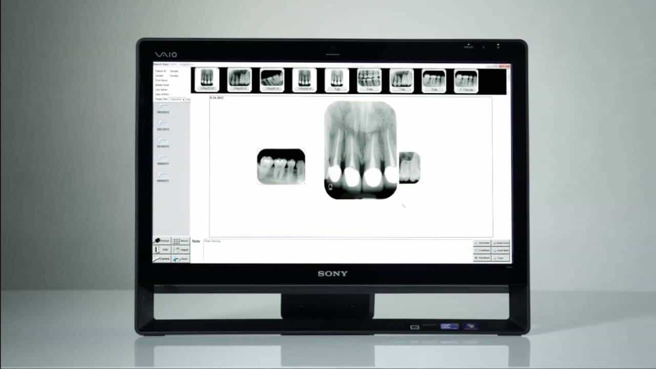 thumbnail image 2 of Scan-X Panoramic Phosphor Plate – 5x12cm – For Air Techniques Scanner (076783016996) 2 of 5