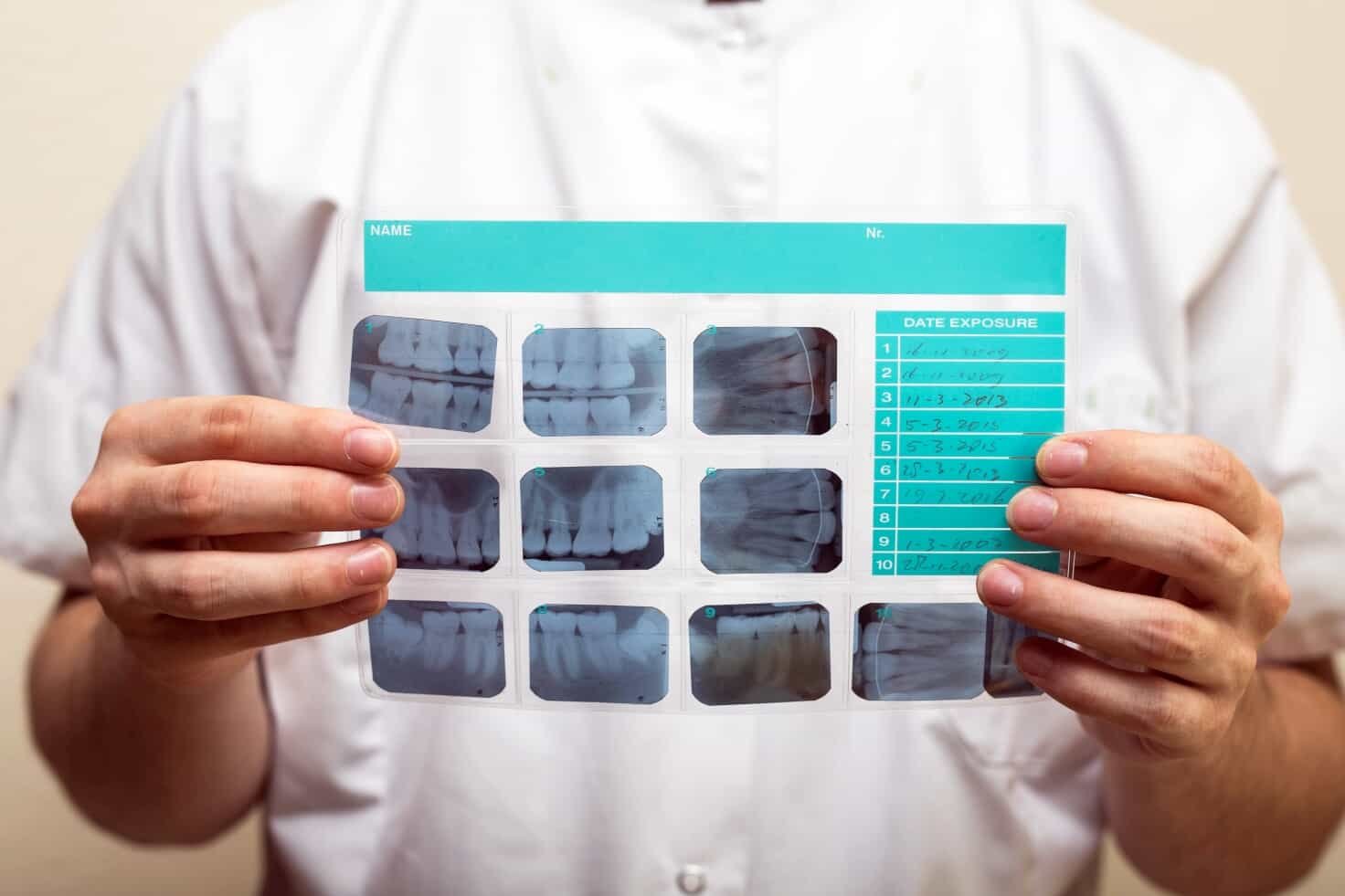 Phosphor Plate Scanners