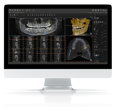 VisionX3d