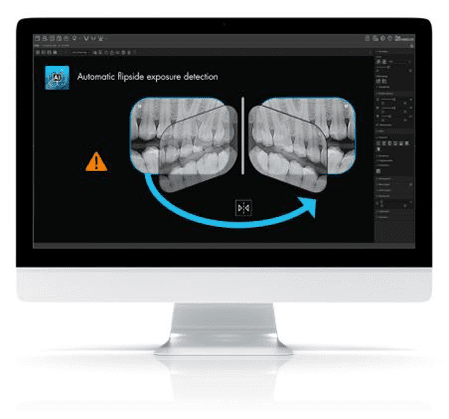 exposuredetection