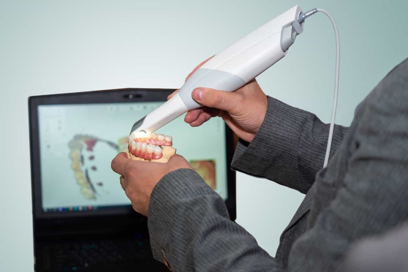Choosing Intraoral Scanner