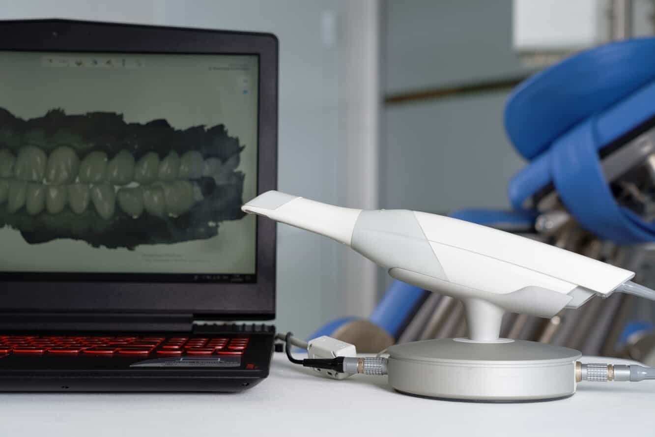 Factors for Selecting an Intraoral Scanner